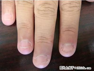 剪指甲、挖耳屎，这些日常小动作竟隐藏大危害！ - 齐齐哈尔生活资讯 - 齐齐哈尔28生活网 qqhr.28life.net